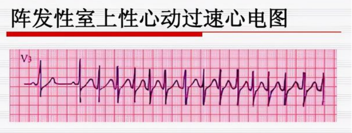 （挂网稿）“心动”是什么感觉373.png