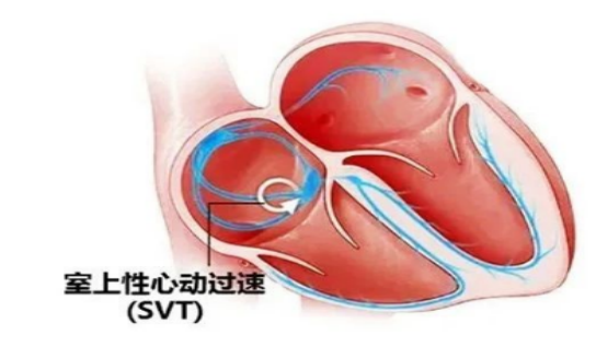 （挂网稿）“心动”是什么感觉469.png