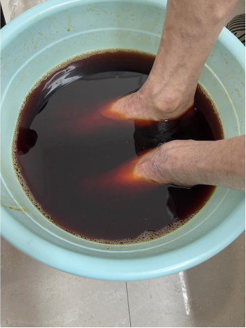 (挂网稿)中西医结合妙治糖尿病足,七旬老人成功避免截肢681.png (挂网稿)中西医结合妙治糖尿病足,七旬老人成功避免截肢681.png